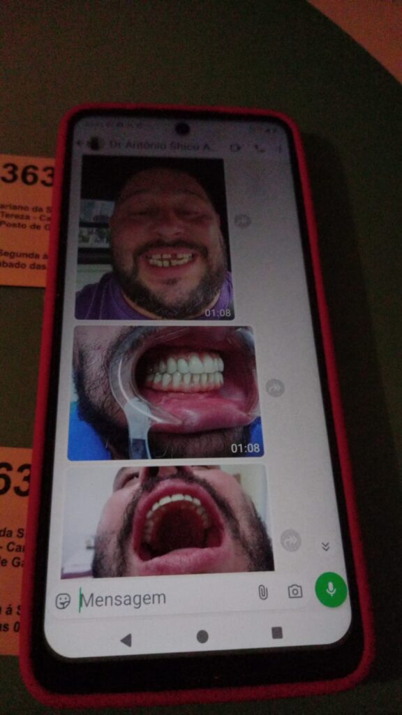 clareamento dental Carapicuíba