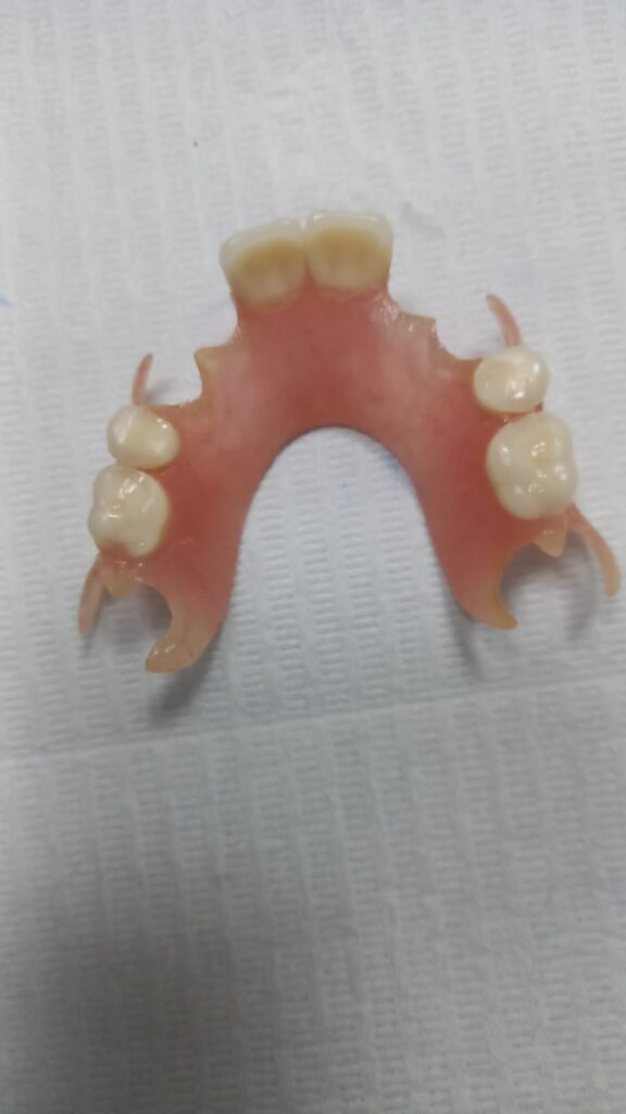 clareamento dental Carapicuíbaclareamento dental Carapicuíba