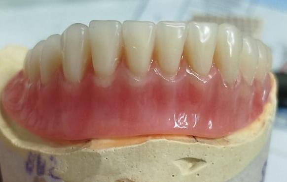 clareamento dental Carapicuíba